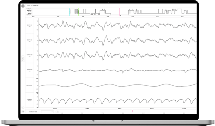 EEG Comp pic